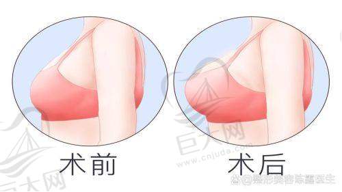 傲诺拉的价格区间全解析