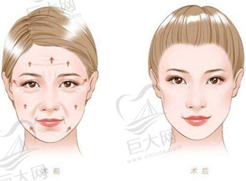 术后修复与护理