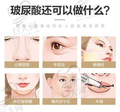 优惠活动