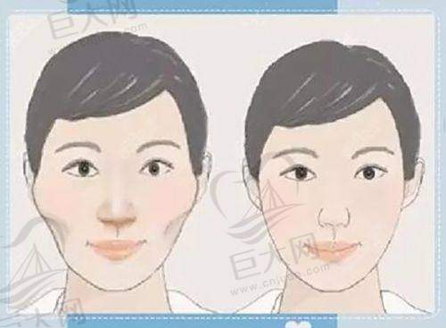 与其他医美机构对比
