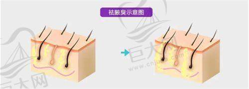 整形手术的注意事项