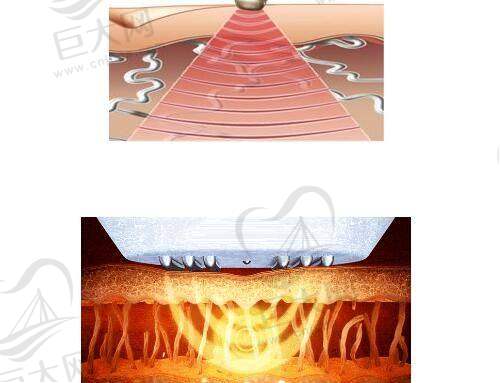 盘锦联合美医疗美容门诊部多项医美价格大公开,双眼皮、隆鼻、提眉等低至4900元