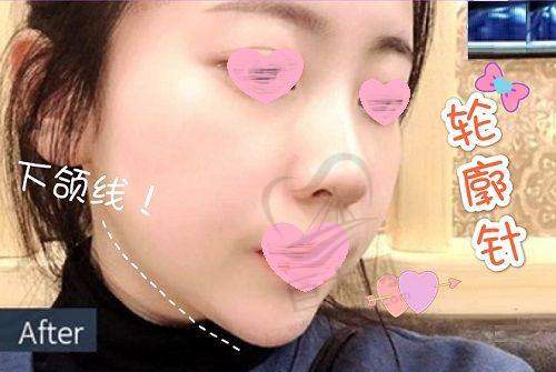 与其他机构对比优势