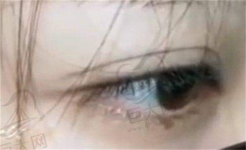 郴州维纳斯整形美容医院鼻综合、丰胸、E光美白等项目价格及收费标准一览