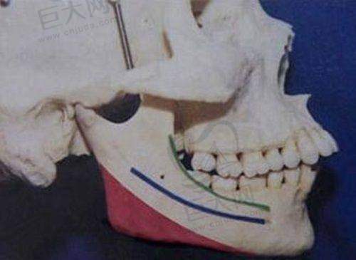 嘉兴海宁维多利亚医疗美容诊所2025年价格表