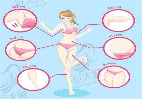 阳江安琪儿妇产医院整形科多项医美项目价格实惠,双眼皮2800元起、隆胸5800元起