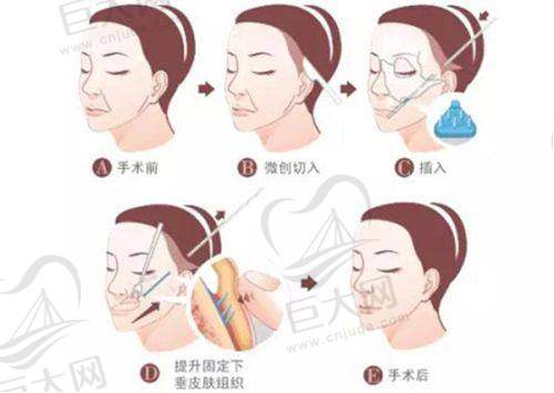 辽源新华医疗整形诊所光子、激光美容等项目价格如何?收费合理能改善多种肌肤问题