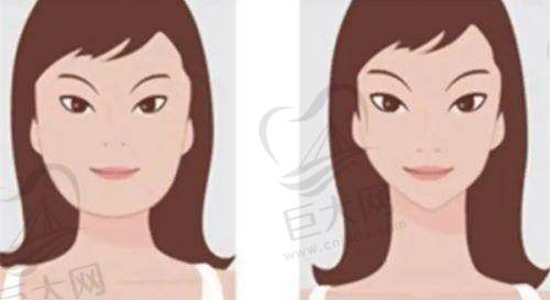 潜江蓝鸟医疗整形美容诊所周年庆优惠多，种植牙3980元起，重睑最低1980元享5.6折