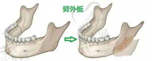 桂林熊名田整形美容诊所本月活动1折,改脸型、激光美容等项目价格及断指再植收费情况