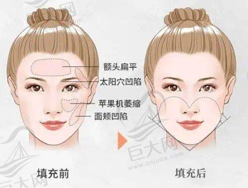 郴州市人民医院整形美容科眼部修复、彩光祛斑等项目价格曝光,最低1070元