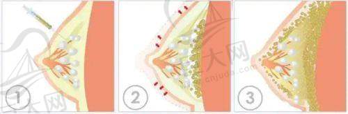 信阳美尔医疗美容门诊部福利来了!种植牙3980元起,重睑5.6折,植发低至5元一单位