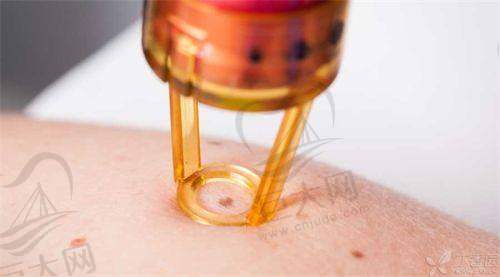 辽源大地红医疗美容诊所2025年价格表