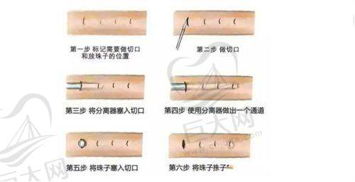 郴州星辰铭医医疗美容门诊进口假体隆鼻效果好价合理,多项医美项目价格实惠