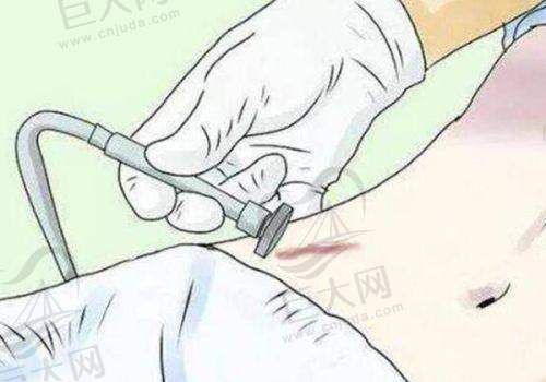 选择诊所的考量因素