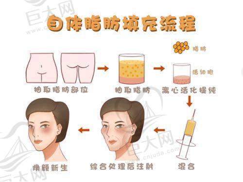 选择郴州曹家整形医疗美容门诊部的理由