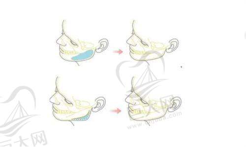 郴州禾美荟医疗美容门诊头发种植价格实惠，不剃发植发改善额头脱发还养护舒适