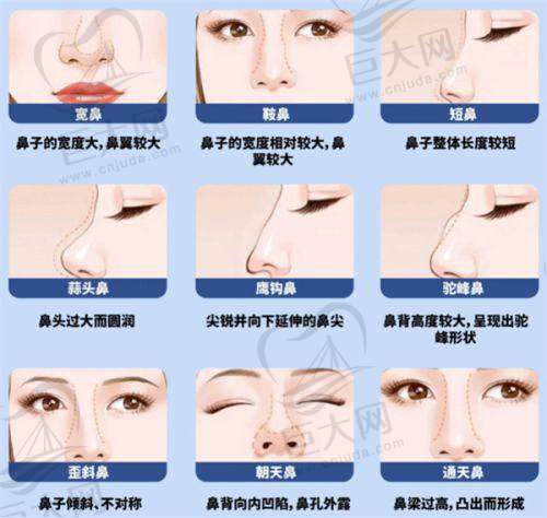 激光美白项目及收费