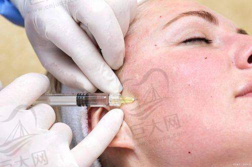 安庆现代医美医院控油定妆针解决肌肤出油,仅799元起!丁应忠陈万芳等医生护航