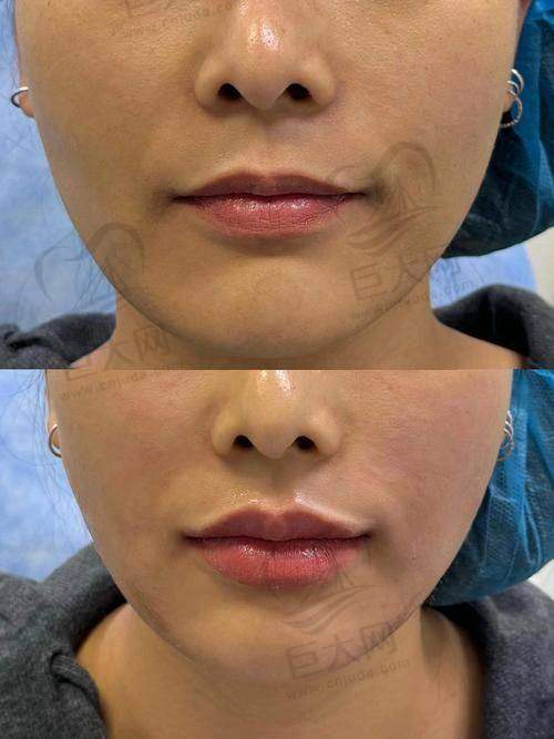 可能存在的风险