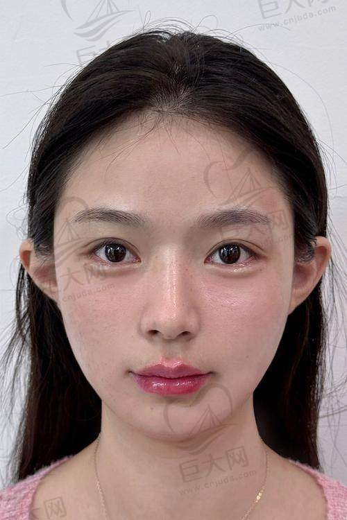 价格便宜的原因