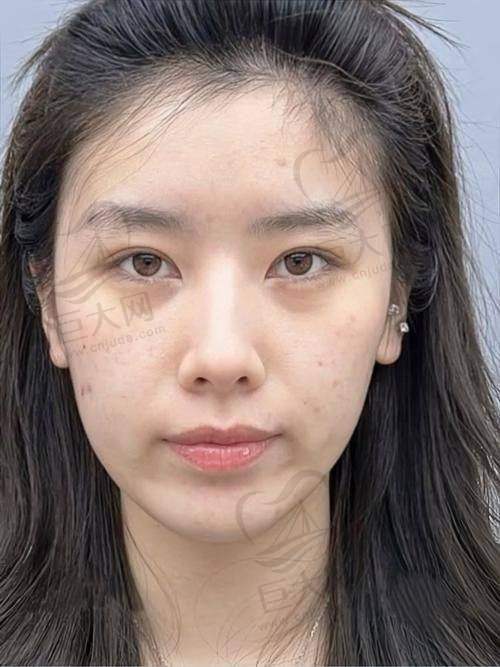 选择医院的要点