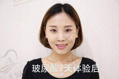 赴韩打玻尿酸建议