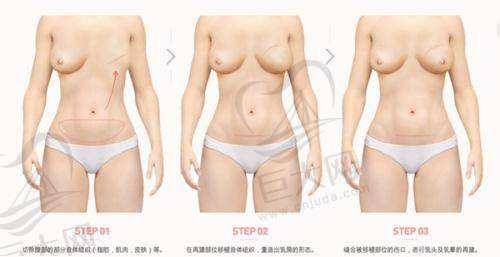 眼部整形项目价格丰富