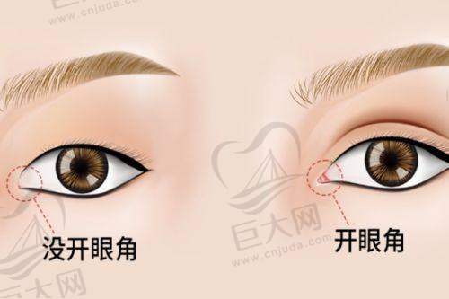 南京鼻修复医生洪志坚朱刚强对比