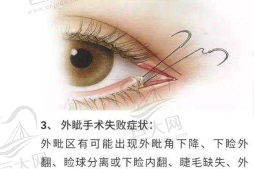 大连沙医生整形美容医院整形项目收费价格:割双眼皮+开眼角7820元起、花瓣唇7000元起