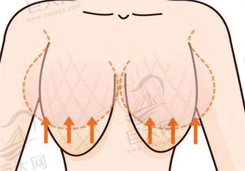 理性选择整形项目特别重要