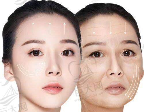 佛山曙光金子整形面部提升收费价格：双矢量筋膜23,800 - 98,000元，时光绷带待沟通