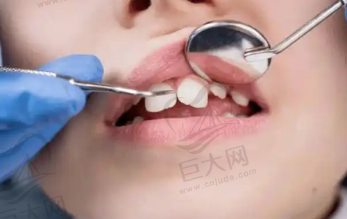 徐州博爱口腔医院医生技术水平如何