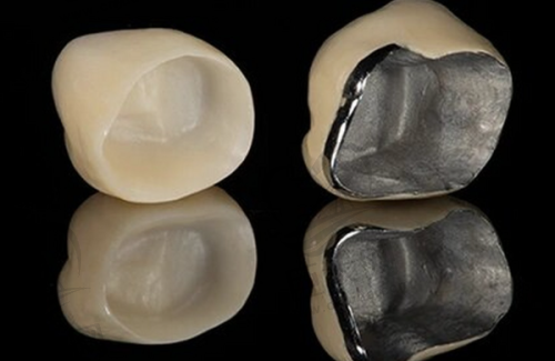 2025年青少年牙齿正畸价格范围