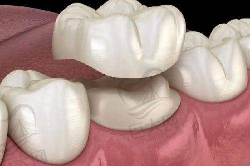 上海博厚口腔医院的服务质量好不好