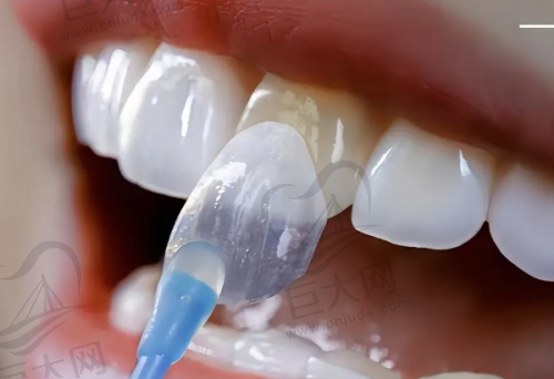 北京佳美口腔价格受关注!剖析贵的原因、对比价格优势,看高价是否配服务及高价项目