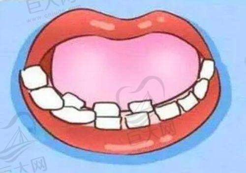 河南郑州植得口腔12家分院地址曝光，镶牙3890 - 1.5万、种植牙各有价位，比公立医院省钱！