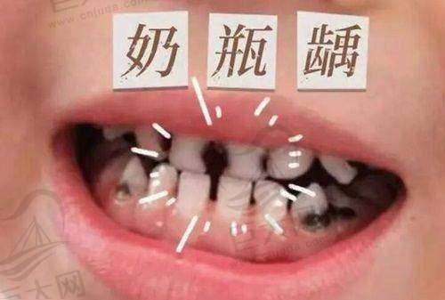 徐州博爱口腔医院的特色项目有哪些