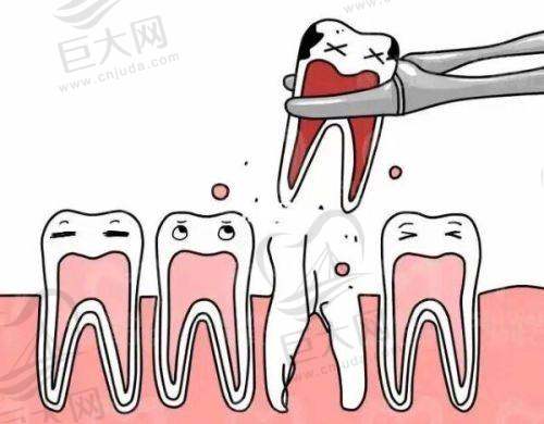 武汉同济医院牙科武汉同济医院牙科绞正牙齿好多少钱？矫正8000元起，隐适美全隐形矫正35000元起，收费合理口碑好，