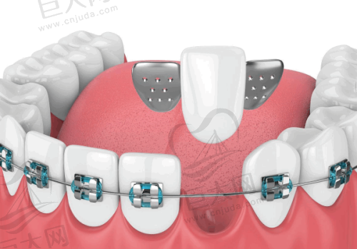 海南海口排名前十牙科医院的收费标准