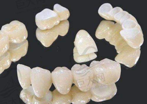 梅州泽山口腔2025价目表曝光:国产种植牙低至3502元,各项目收费与价值全了解