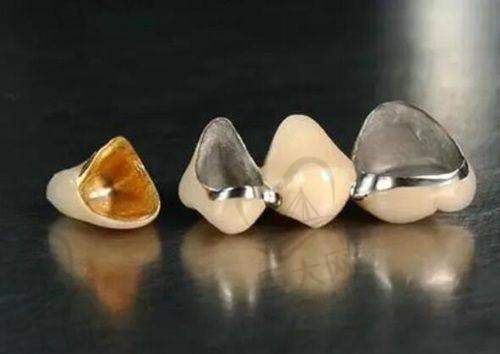 邢台排名靠前的牙科诊所优势分析 - 邢台国华口腔医院