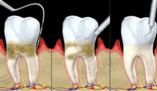2025年隐形牙齿正畸价格表