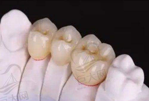 烟台各口腔医院儿童口腔治疗收费价格表