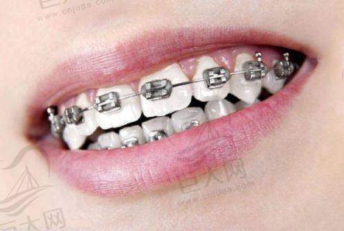 查询河南郑州植得口腔医院地址及性价比高的项目价格