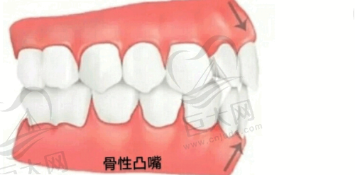 昆明不同类型口腔疾病对应的优质医院