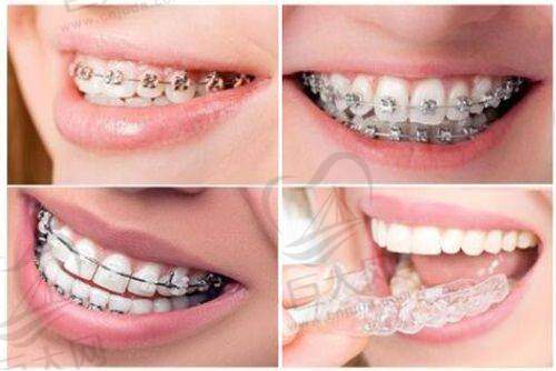 宁波市区口腔医院更新后的儿童牙科收费标准