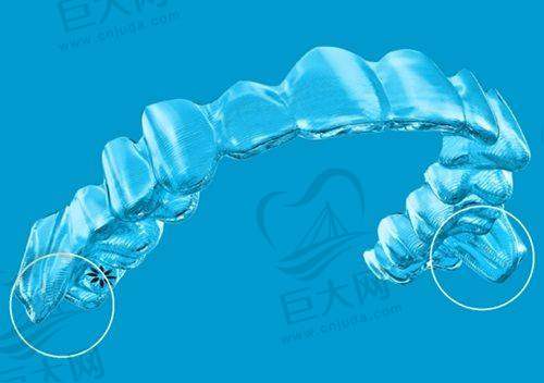 上海博厚口腔医院口碑好收费合理，单颗种植牙低至980元起，医生技术强设备先进服务佳