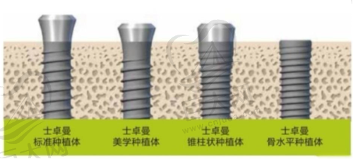 做半口全口种植牙6年后的口腔健康状况