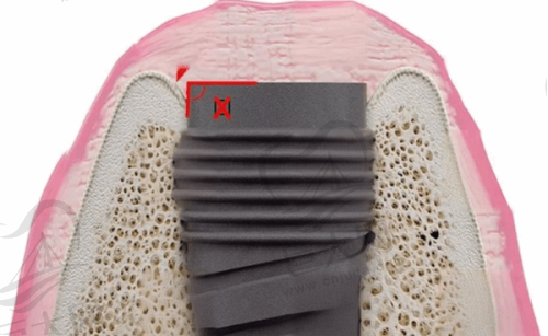 昆明技术好的口腔医生所在医院