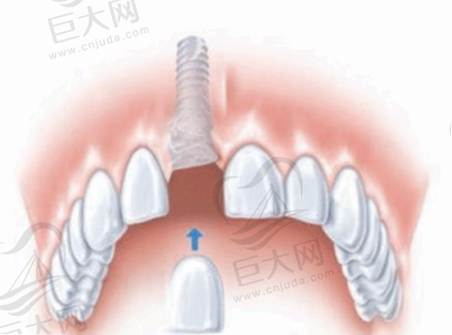 长春拜博口腔门诊部医生技术水平如何